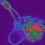 calcium4 Calcium image of in vitro renal glomerulus