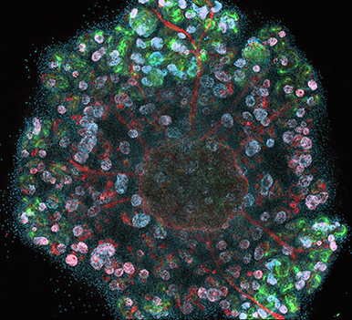 Stem cell kidney